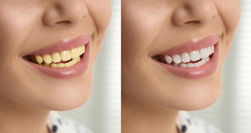 teeth-ew.jpg